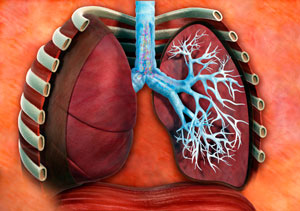 Бронхит - фото