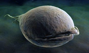 лечение трихомониаза у мужчин и женщин